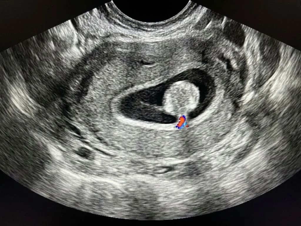 Clinical image for NEET PG 2020 Q56