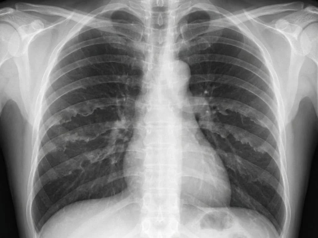 Clinical image for NEET PG 2020 Q172