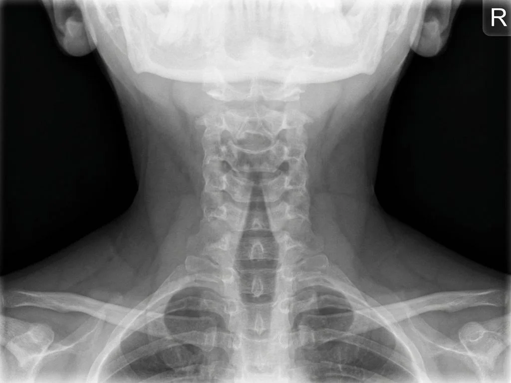 Clinical image for NEET PG 2020 Q272