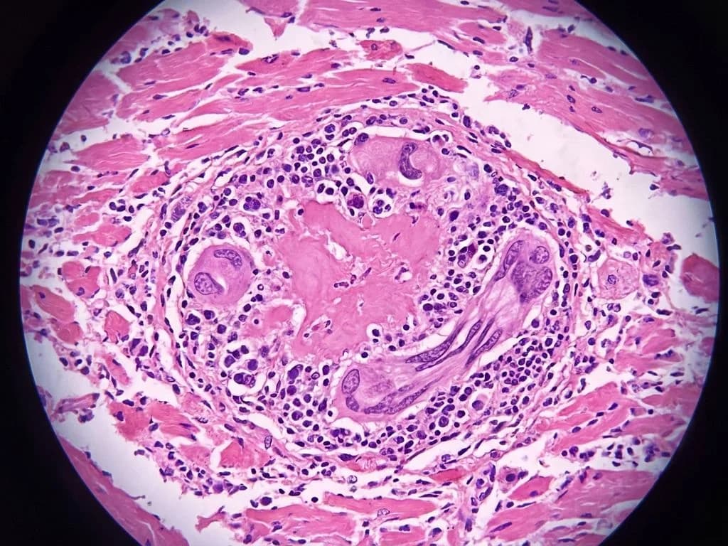 Clinical image for NEET PG 2021 Q195