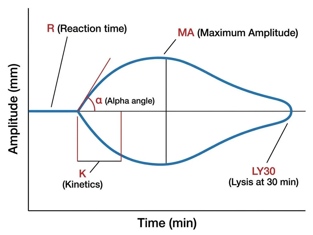 Clinical image for NEET PG 2022 Q143
