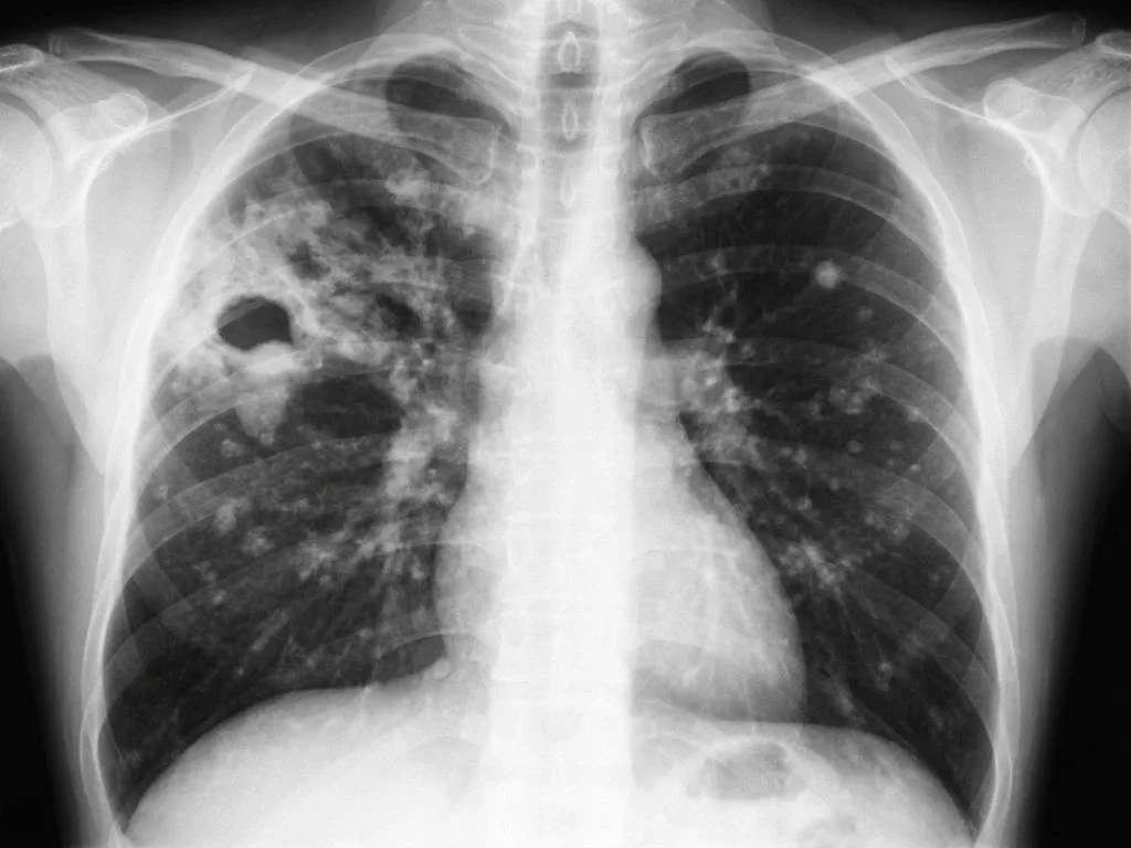 Clinical image for NEET PG 2023 Q189