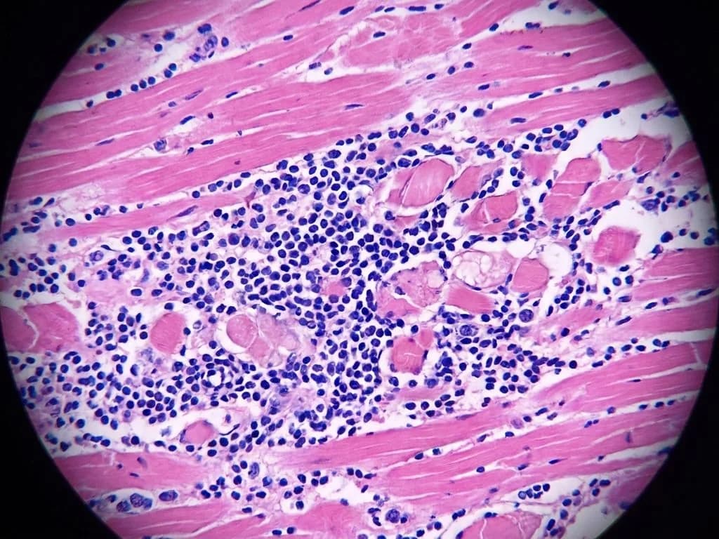 Clinical image for NEET PG 2023 Q194