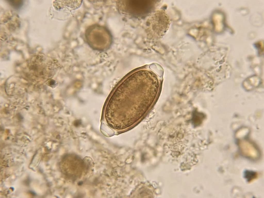 Clinical image for NEET PG 2020 Q233