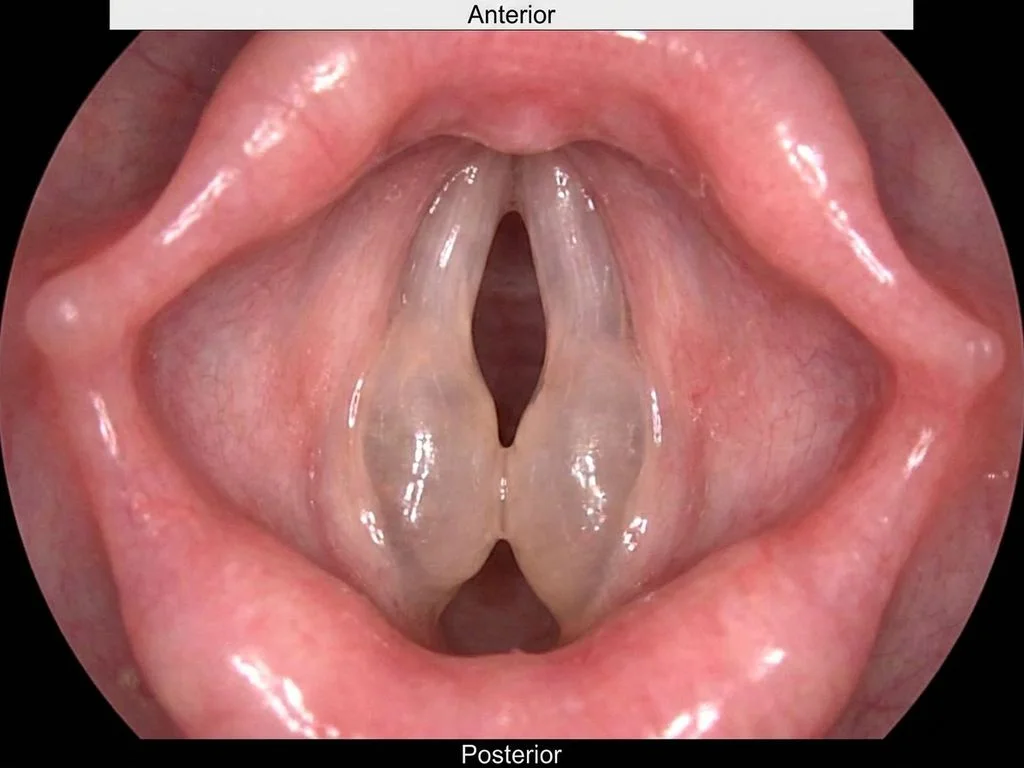 Clinical image for NEET PG 2019 Q73