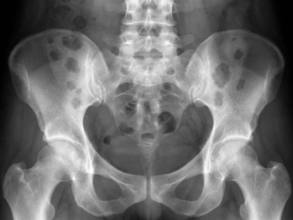 Clinical image for NEET PG 2019 Q109