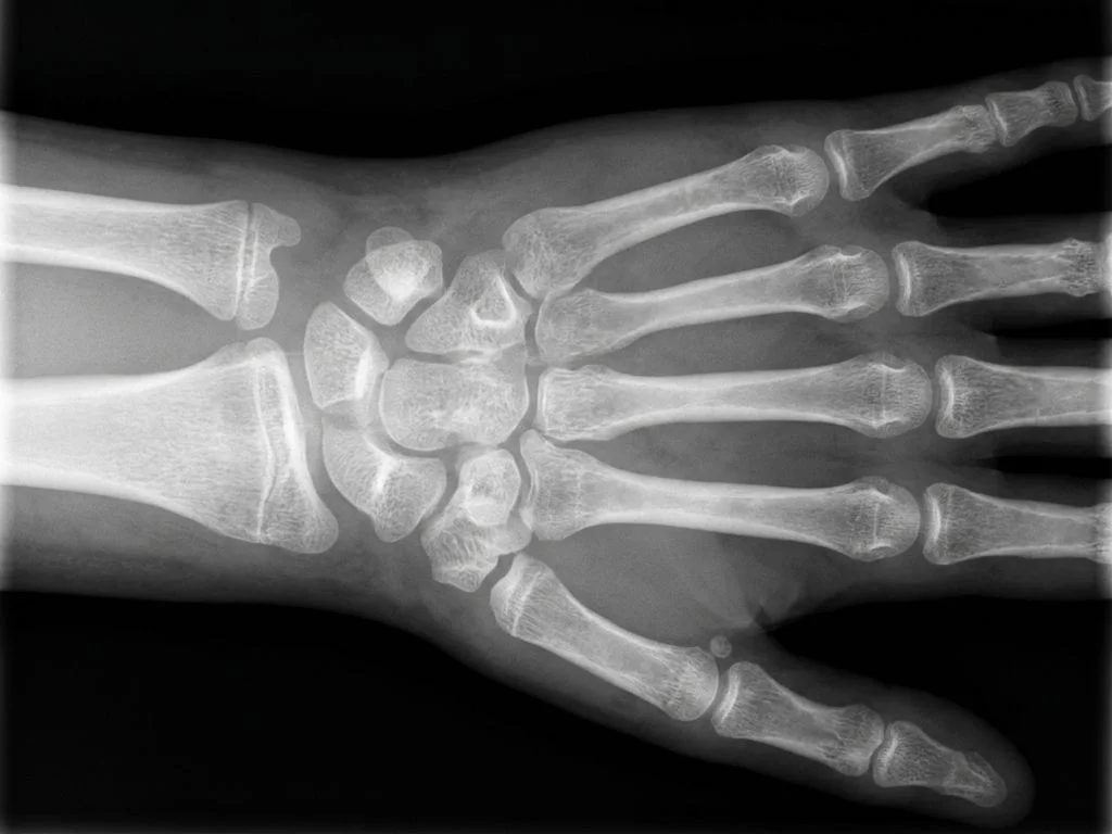 Clinical image for NEET PG 2020 Q278