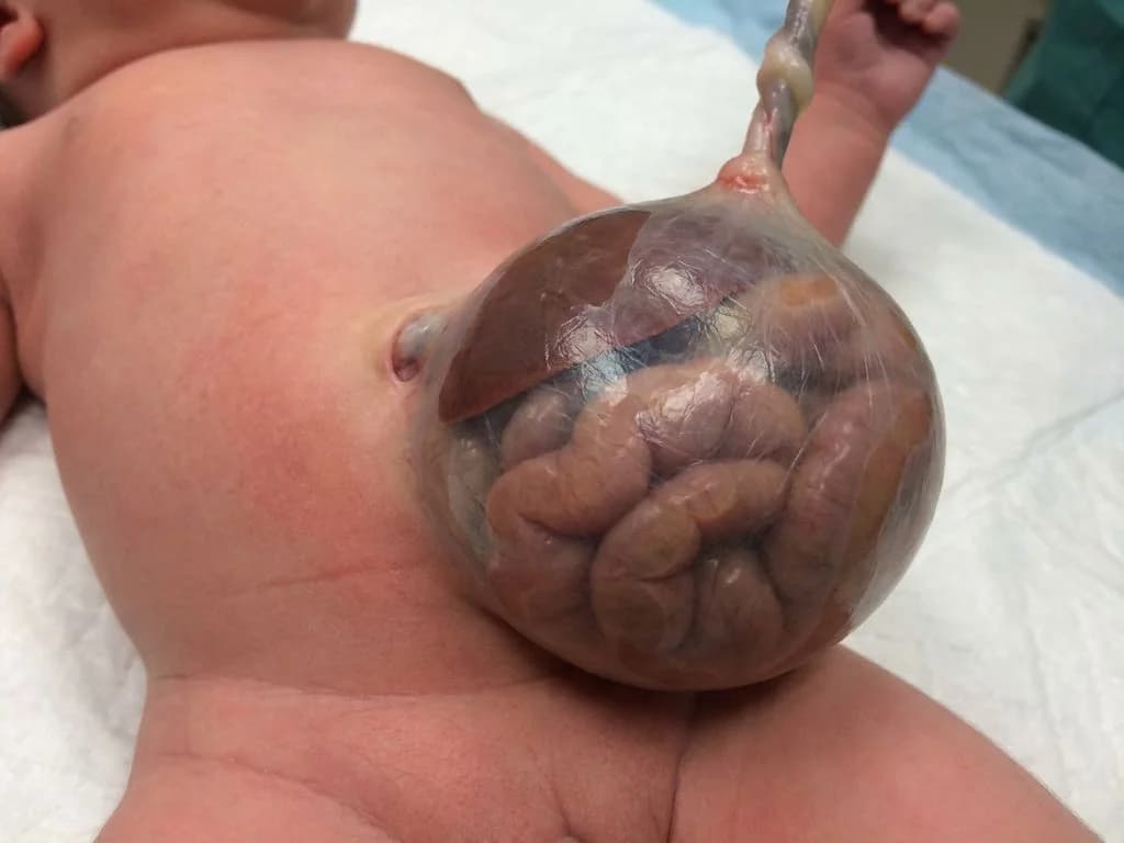 Clinical image for NEET PG 2022 Q144