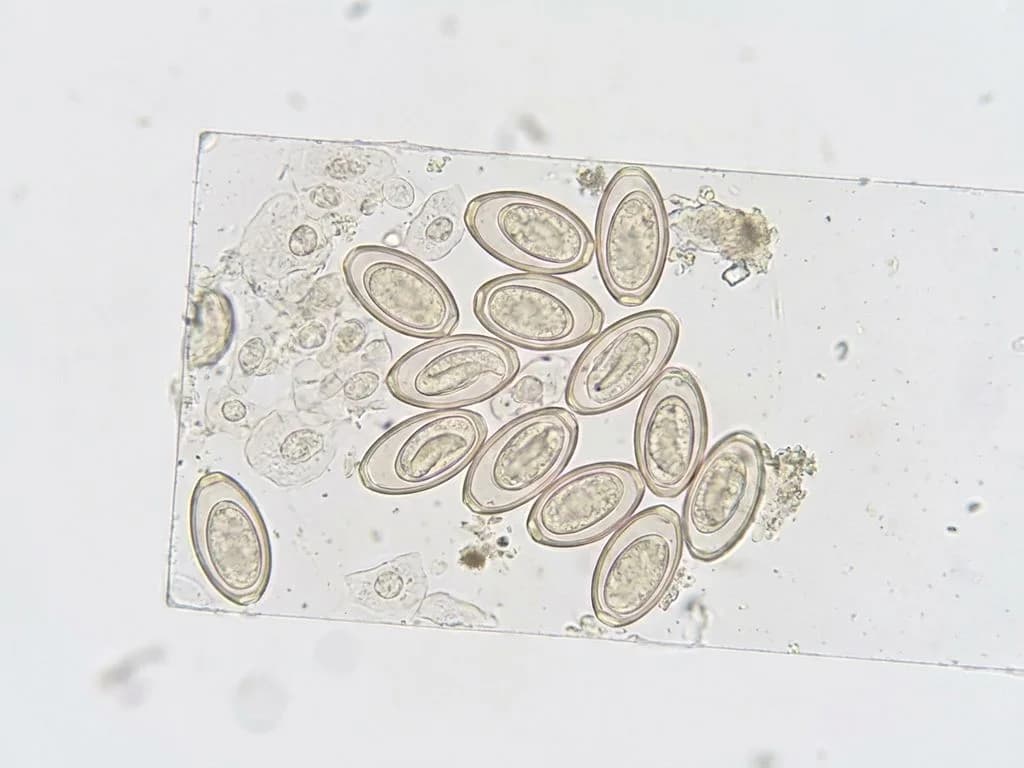 Clinical image for NEET PG 2025 Q46