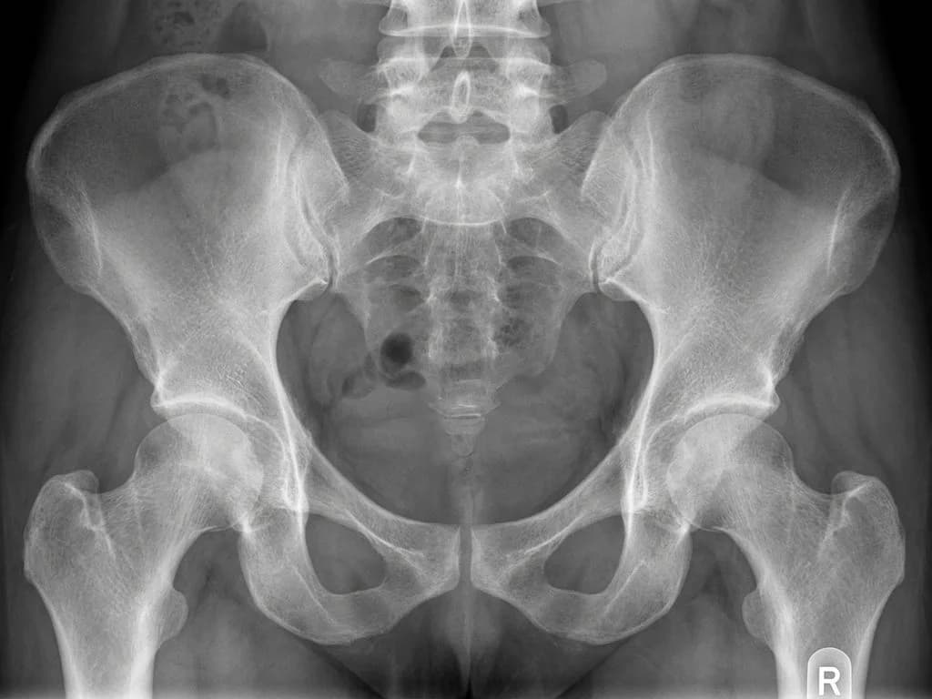 Clinical image for NEET PG 2025 Q125