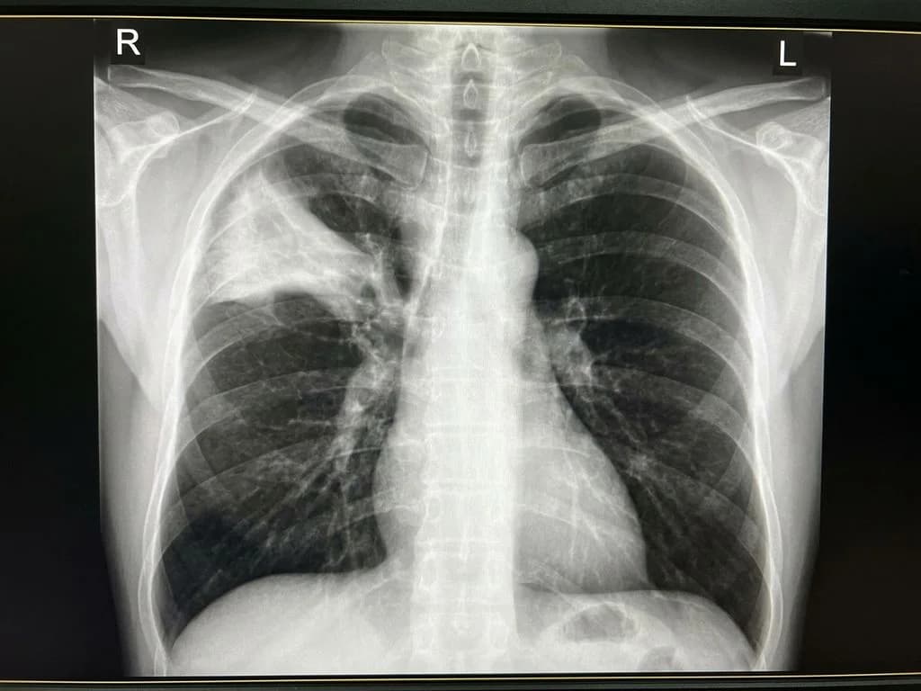 Clinical image for NEET PG 2025 Q184