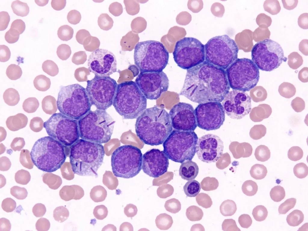 Clinical image for NEET PG 2025 Q25