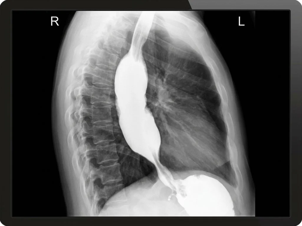 Clinical image for NEET PG 2025 Q186