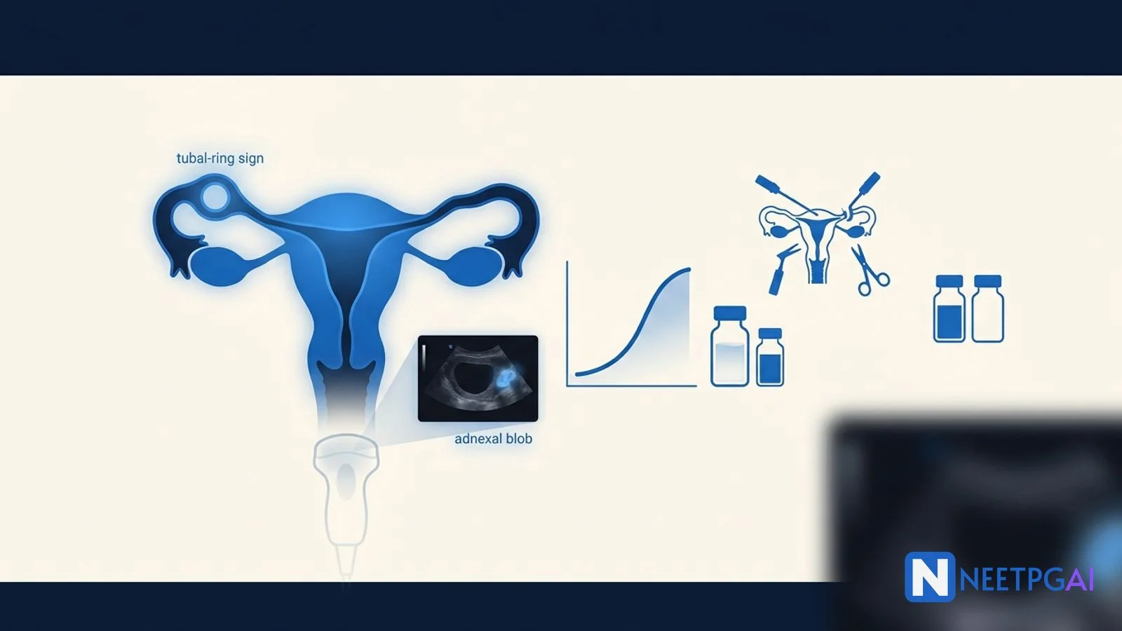 Ectopic Pregnancy for NEET PG 2026: β-hCG, TVS, Methotrexate, Surgery