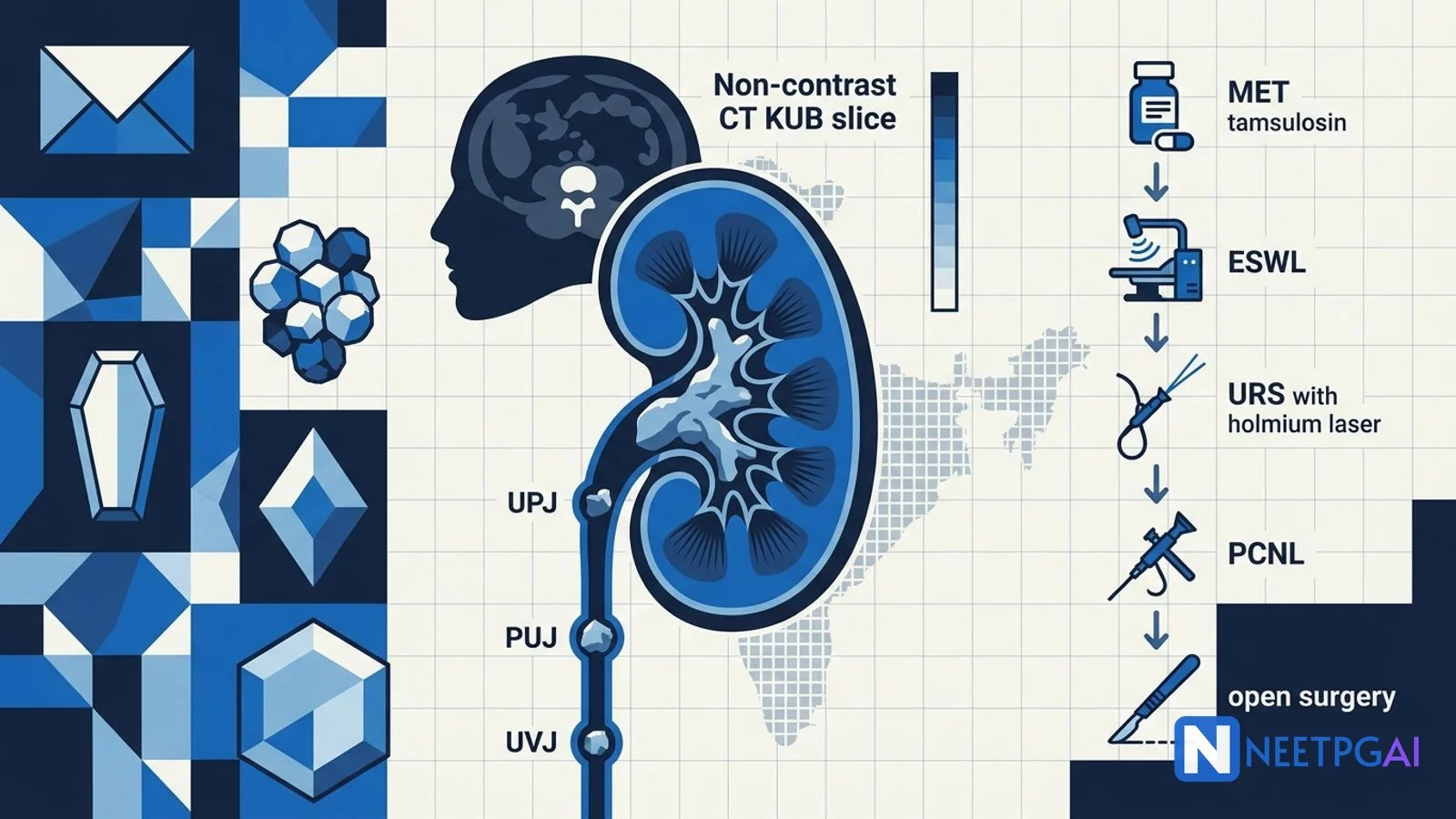 Kidney Stones for NEET PG 2027: Stone Composition, ESWL, URS, PCNL