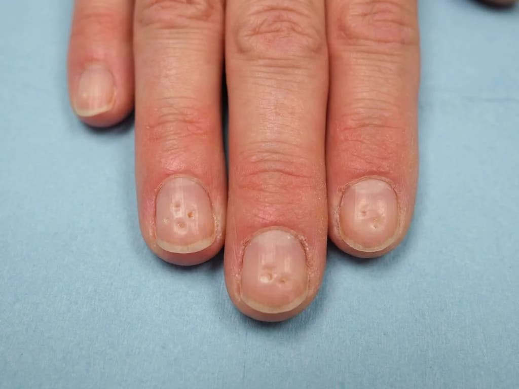 Clinical image for NEET PG 2019 Q59