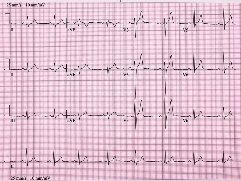 Clinical image for NEET PG 2019 Q255
