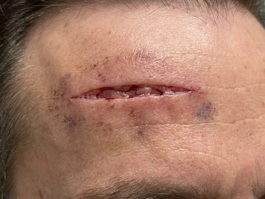 Clinical image for NEET PG 2021 Q62