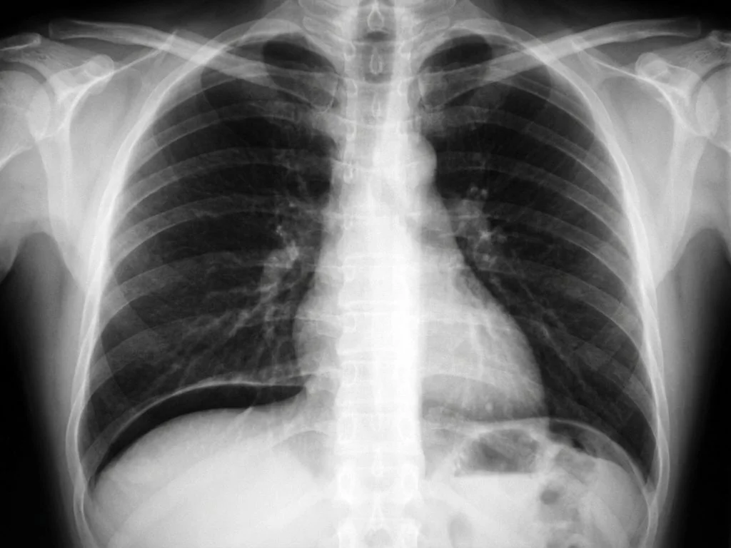 Clinical image for NEET PG 2021 Q199