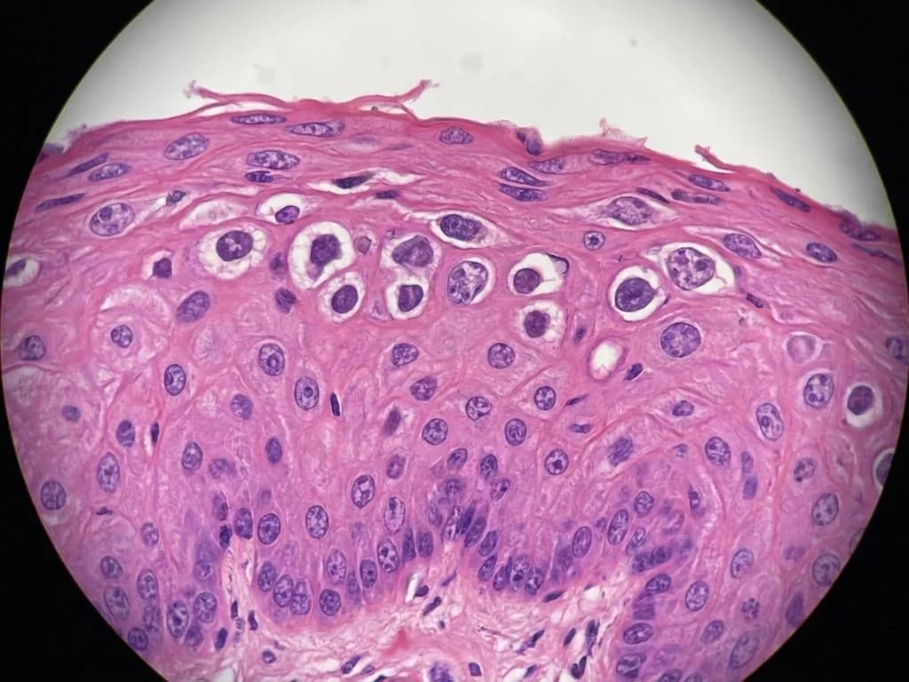 Clinical image for NEET PG 2022 Q6