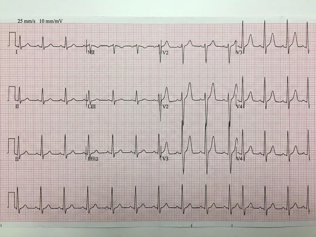 Clinical image for NEET PG 2022 Q170