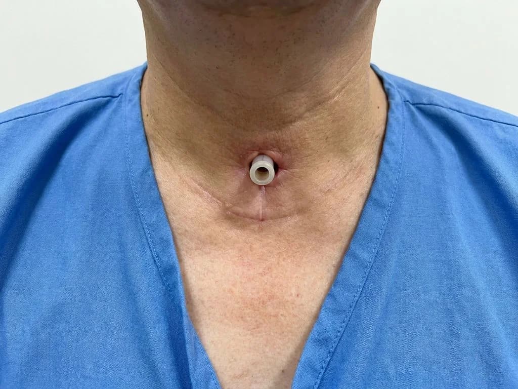 Clinical image for NEET PG 2023 Q57