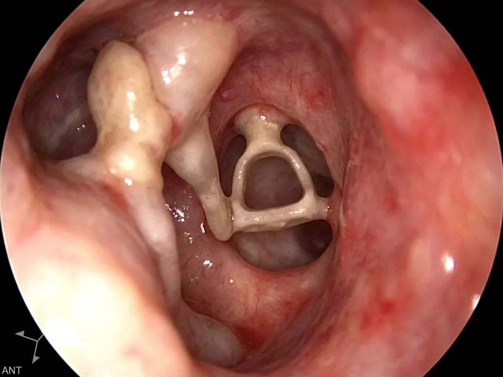 Clinical image for NEET PG 2022 Q8