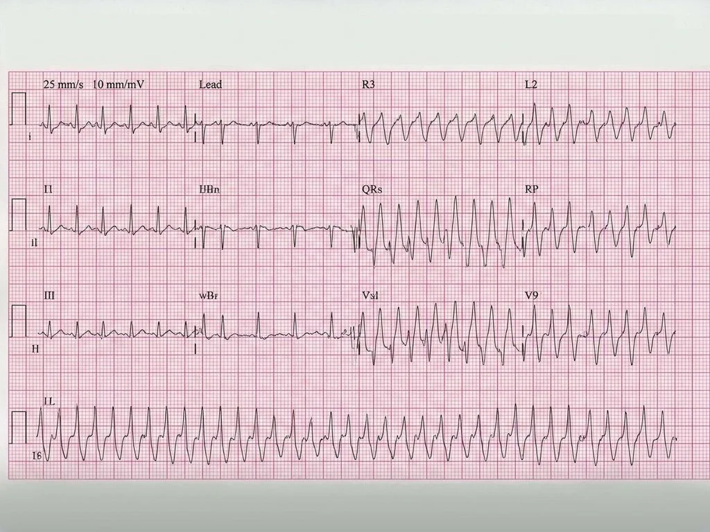 Clinical image for NEET PG 2022 Q21
