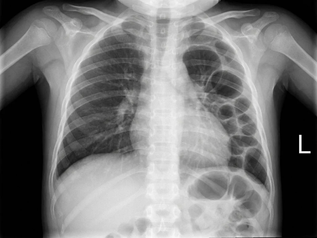 Clinical image for NEET PG 2025 Q157