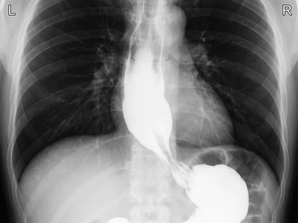 Clinical image for NEET PG 2025 Q128